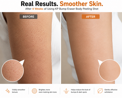Dr. Melaxin Peel Shot — Kojic Acid Turmeric Body Spray